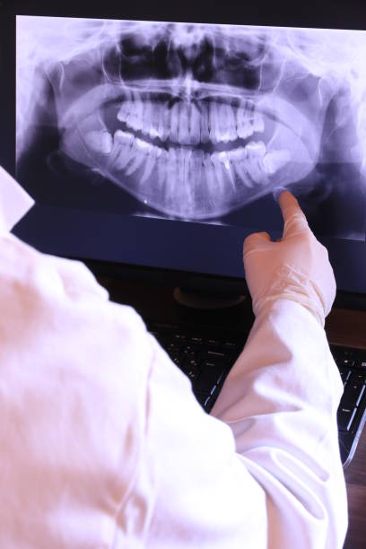Best Dental Abscess Treatment in Snyder, TX