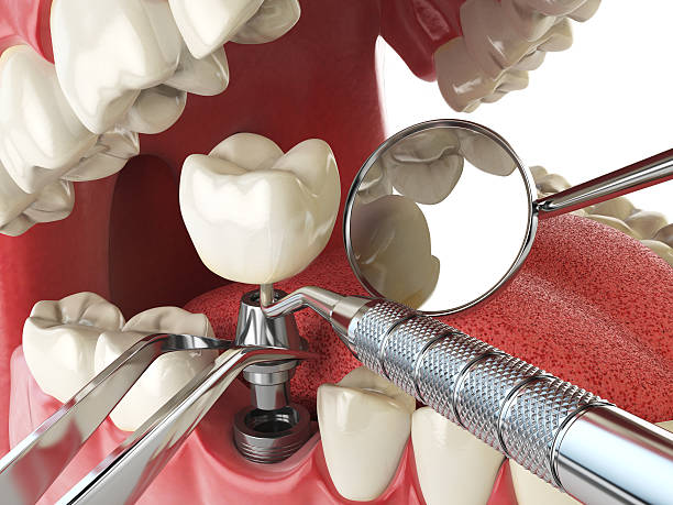 Best Emergency Treatment for Oral Infections in Snyder, TX